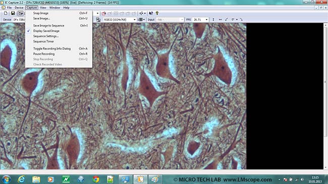 Mikroskopbilder speichern mit IC capture Adapterlsung