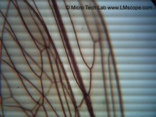 Fehlersuche flackern in der Mikroskopie