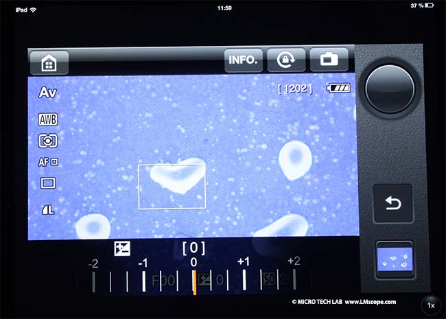 microscope camera live view image on tablet