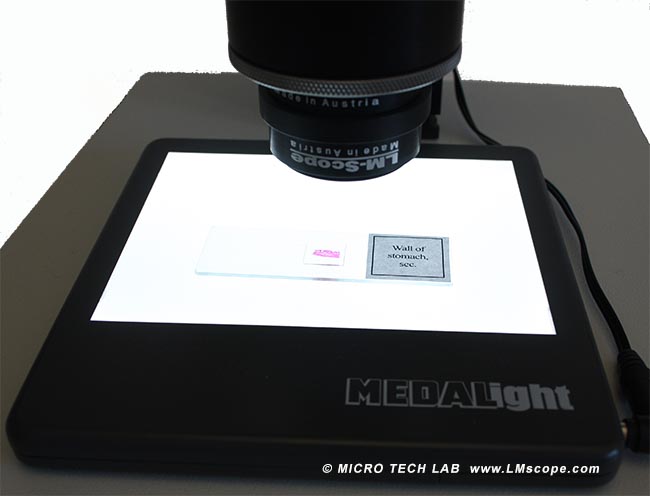 Diadurchlicht Mikroskop Beleuchtung