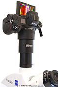 Zeiss Primostar 3: Steigerung der Bildqualitt mithilfe des LM Mikroskop Adapters durch aktuelle Kameratechnik
