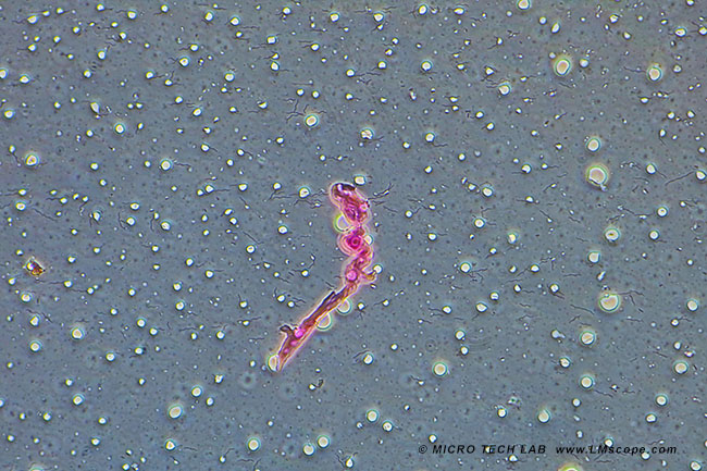 Spirillen, Canon EOS 5DS sur microscope Zeiss Axioskop avec adaptateur numrique LM