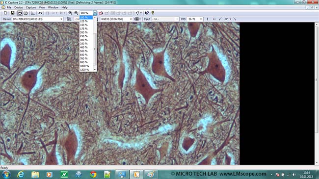 IC capture zoom pour microscopie