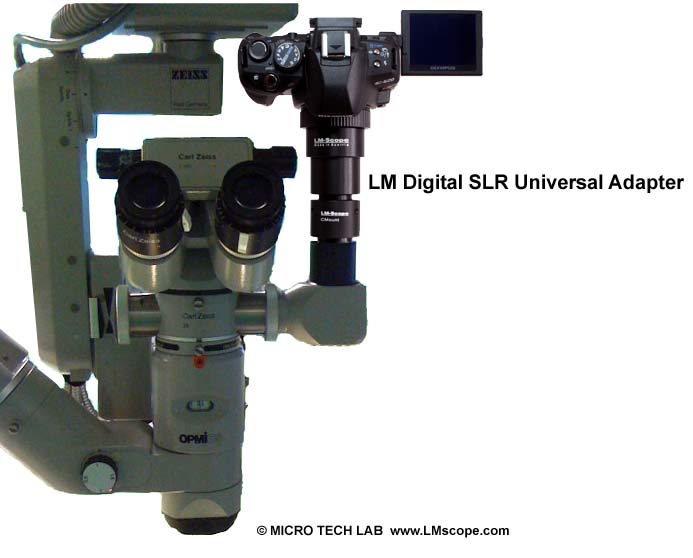 Zeiss OPMI mit LM digital SLR Universal Adapter und Kamera