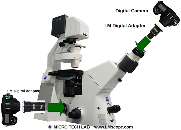 LM Mikroskopadapter Varianten auf dem Zeiss Observer