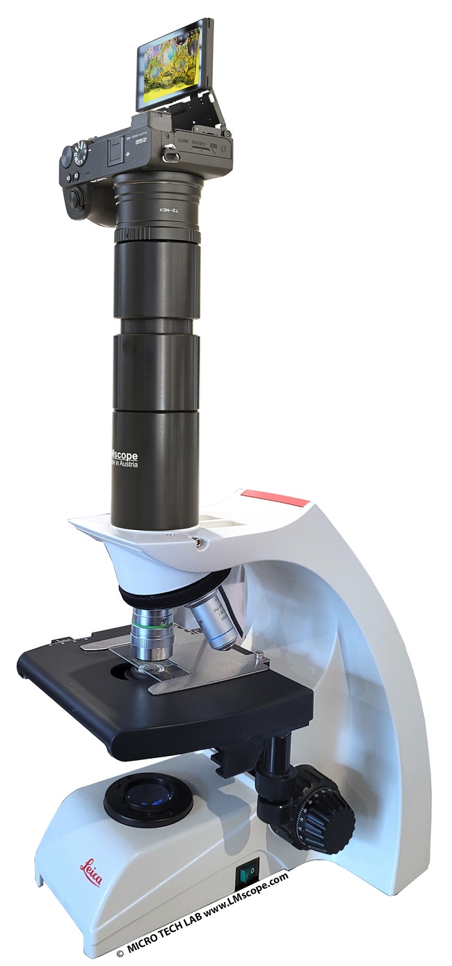 Ultra-widefield direct stand adapter microscope photography without trinocular head