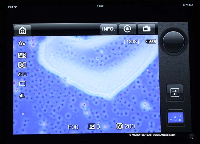 Mikroskop Live View Adapterlsung