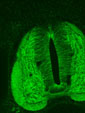 Vorschaubild Confocal Matrix