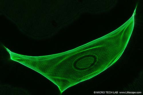 Galera web: fotos creadas con cmaras digitales, adaptadores de microscopio, macroscopios LM, lentes macro extremas, lentes macro adicionales,DSLR,DSLM