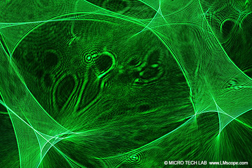 The Sony Alpha 6600 on the microscope – transform this mid-range