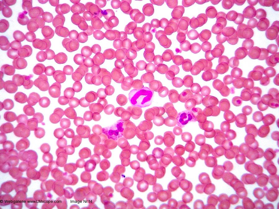 Blood under the Microscope: Blood film