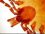 Tick under the microscope