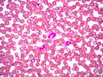 Blut unter dem Mikroskop: Blutausstrich