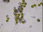 spores de la morchella (morille)