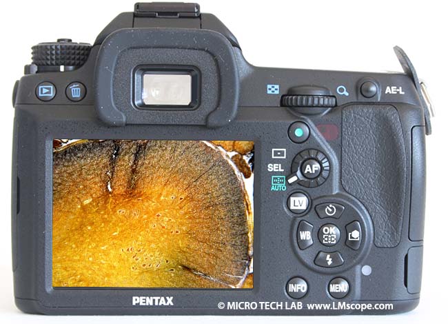 Pentax K-5 IIs backvies spinalpicture microscopy