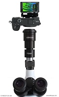 Das Bresser Zoom Stereomikroskop Advance ICD 10x-160x mit leistungsfhigen Digitalkameras upgraden!