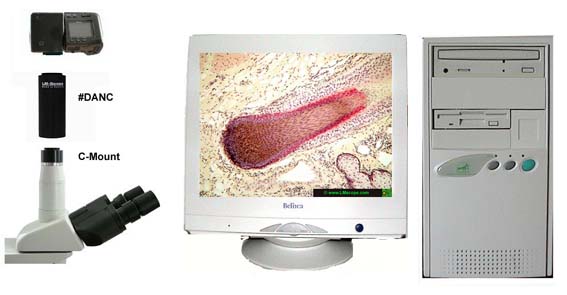 Remote software für Video Ausgang Mikroksopie