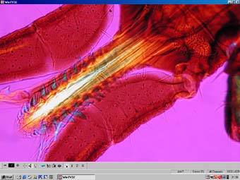 WinTV software for watching microscope videos