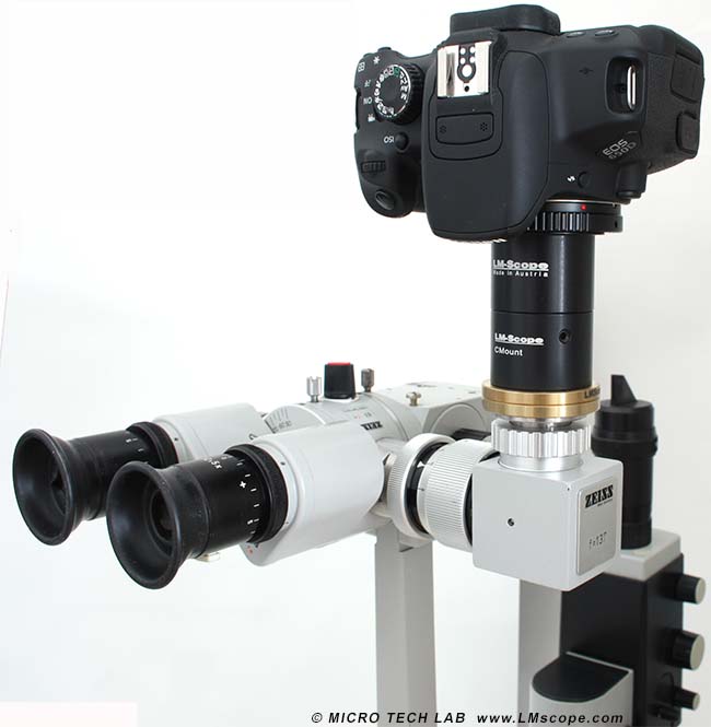 Zeiss Spaltlampe Fotoanbindung LMscope Adapter Canon DSLR Kamera