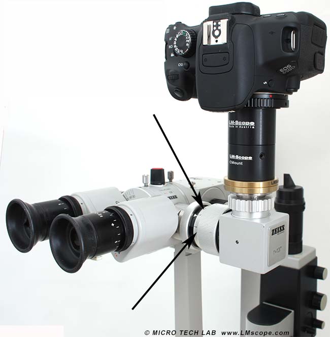 zeiss Spaltlampe Irisblende Fotoanbindung LMscope Adapter