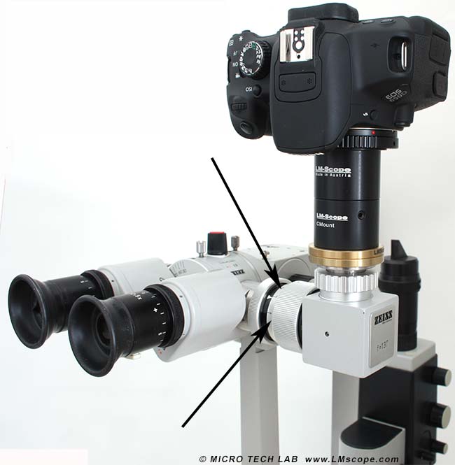 zeiss slit lamp photo port LMscope Adapter